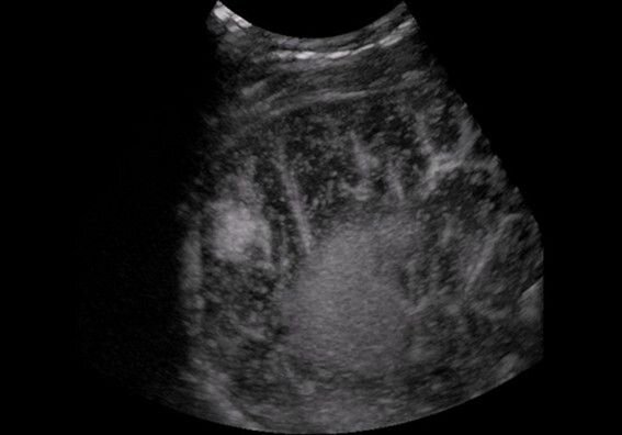 Аппарат УЗИ Mindray DC-8