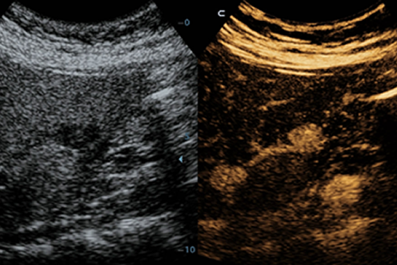 УЗИ аппарат Mindray DC-45