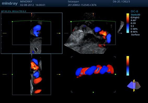 Аппарат УЗИ Mindray DC-8