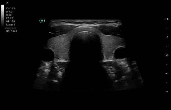 Mindray Consona N8 ультразвуковой аппарат