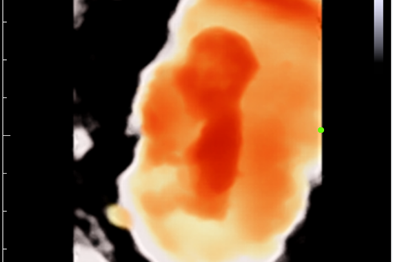 УЗИ аппарат Mindray DC-45