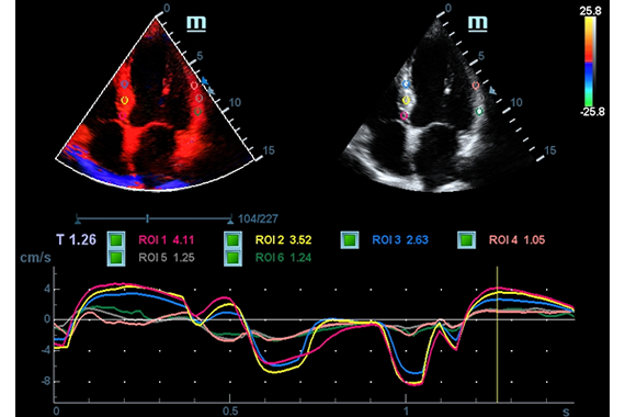 УЗИ аппарат Mindray DC-45