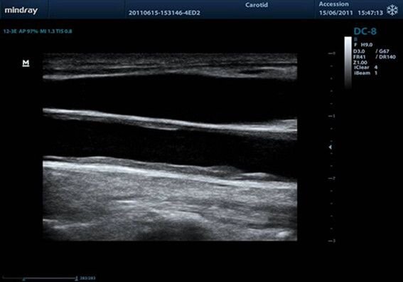Аппарат УЗИ Mindray DC-8