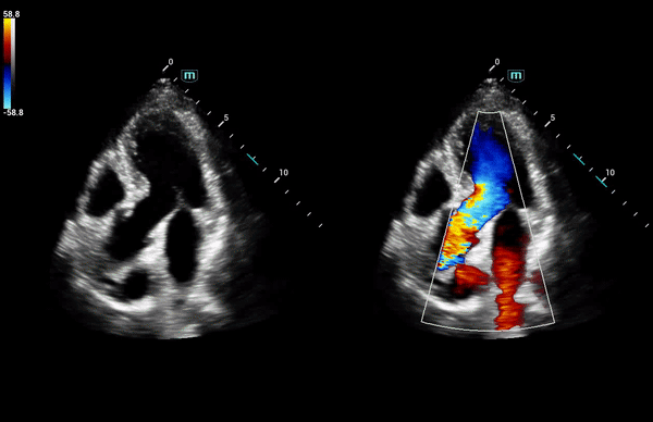 Mindray Consona N8 ультразвуковой аппарат