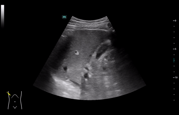 Mindray Consona N8 ультразвуковой аппарат