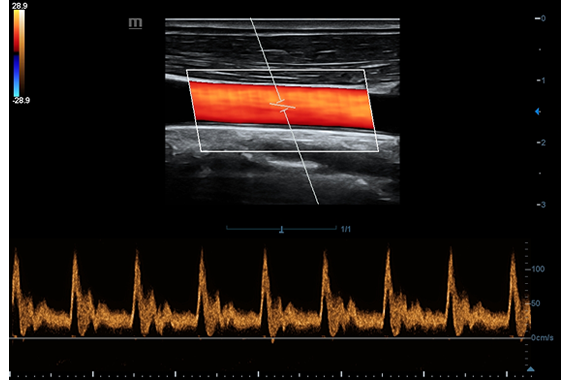УЗИ аппарат Mindray DC-45