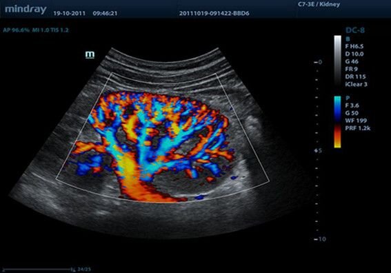 Аппарат УЗИ Mindray DC-8