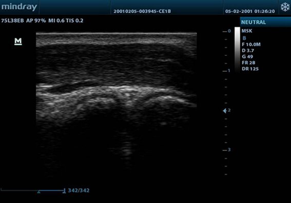 Mindray M9T портативный аппарат УЗИ
