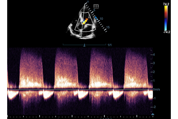 УЗИ аппарат Mindray DC-45