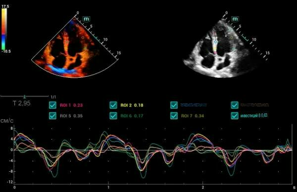 Mindray Consona N8 ультразвуковой аппарат