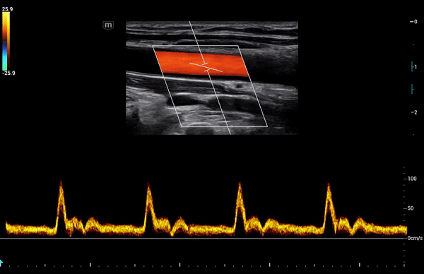 Mindray Consona N8 ультразвуковой аппарат