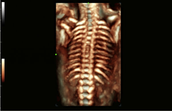 Mindray Consona N8 ультразвуковой аппарат