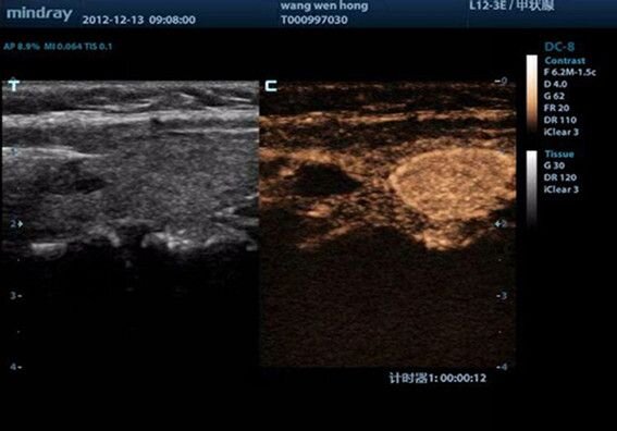 Аппарат УЗИ Mindray DC-8