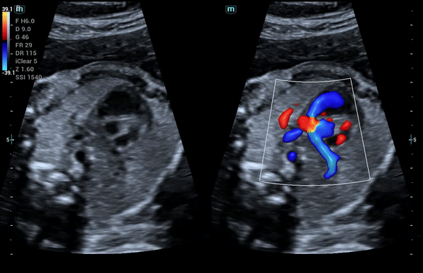 Mindray Consona N8 ультразвуковой аппарат
