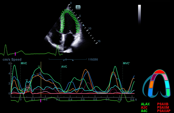 УЗИ аппарат Mindray DC-45