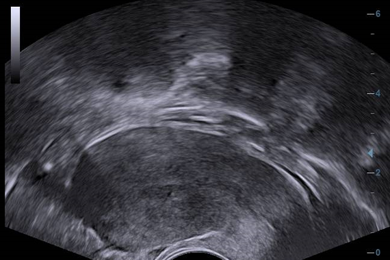 УЗИ аппарат Mindray DC-45