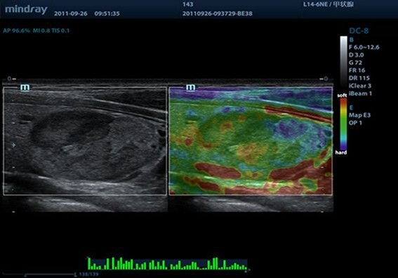 Аппарат УЗИ Mindray DC-8