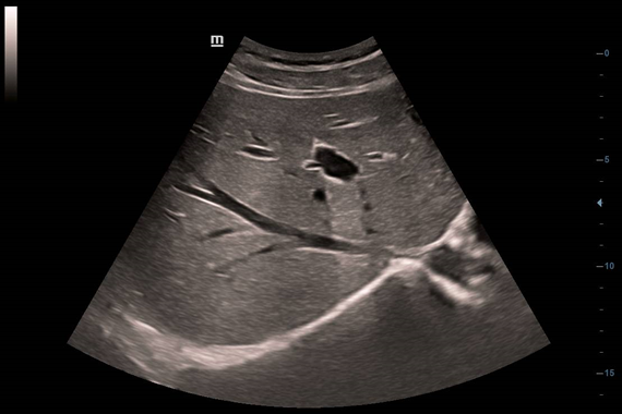 УЗИ аппарат Mindray DC-45