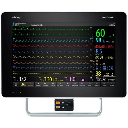 Mindray BeneVision N22 bemor monitori
