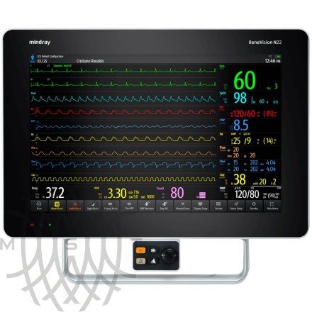 Mindray BeneVision N22 bemor monitori