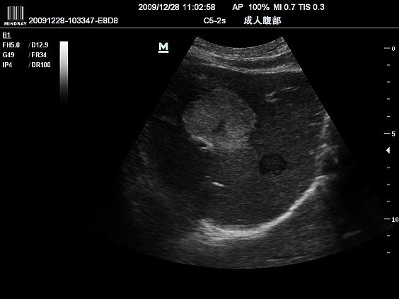 Mindray DC-N6 ультразвуковой аппарат