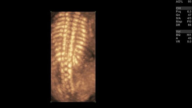 GE Logiq S8 XDclear ультразвуковая диагностическая система