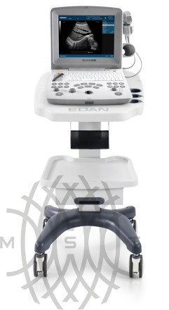 УЗИ аппарат Edan DUS 60