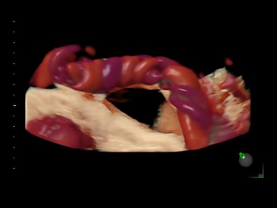 GE Voluson E10 аппарат УЗИ