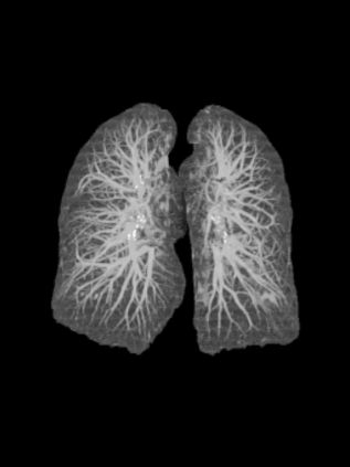 Компьютерный томограф GE Optima CT540 16 (32)