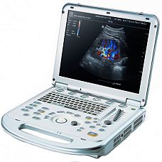 Mindray M7 УЗИ сканер портативный