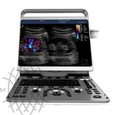 Chison EBit 50 ультразвуковой аппарат