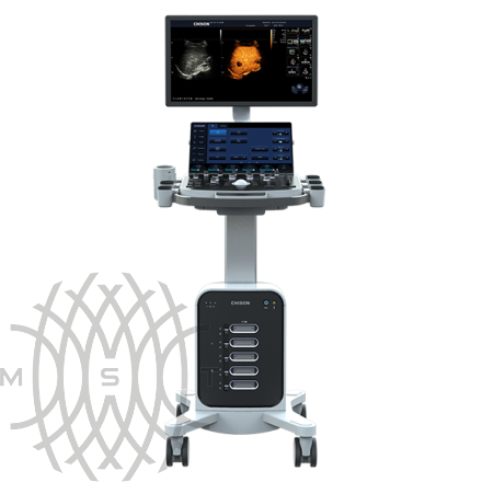 Chison SonoMax 9 ultratovush apparati