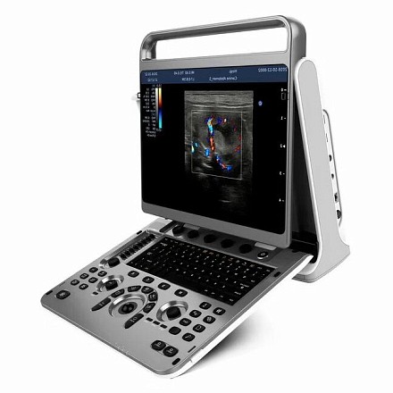 Chison SonoTouch 60 portativ ultratovush apparati