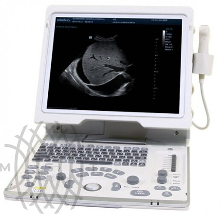 Mindray DP-50 portativ ultratovush apparati