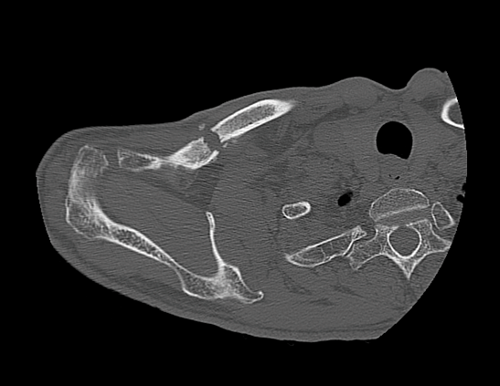Компьютерный томограф GE Optima CT540 16 (32)