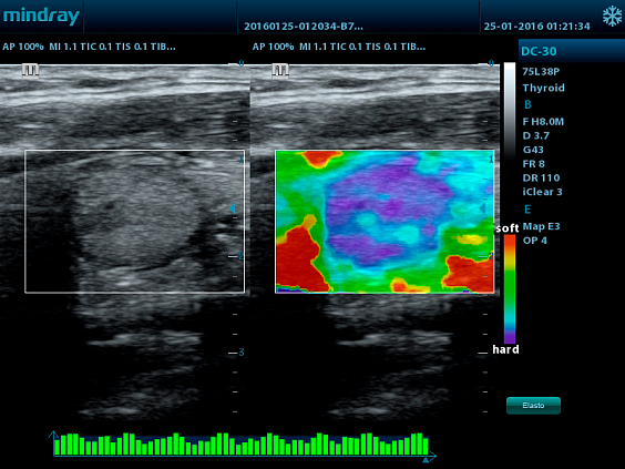 Mindray DC-30 аппарат УЗИ