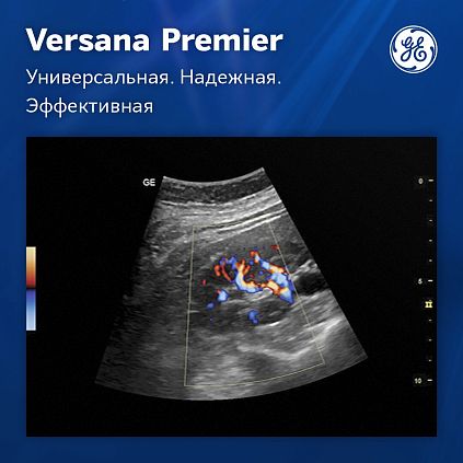 Ультразвуковая система GE Versana Premier Platinum