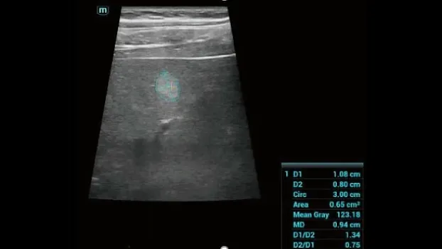 Mindray Consona N7 ультразвуковой аппарат