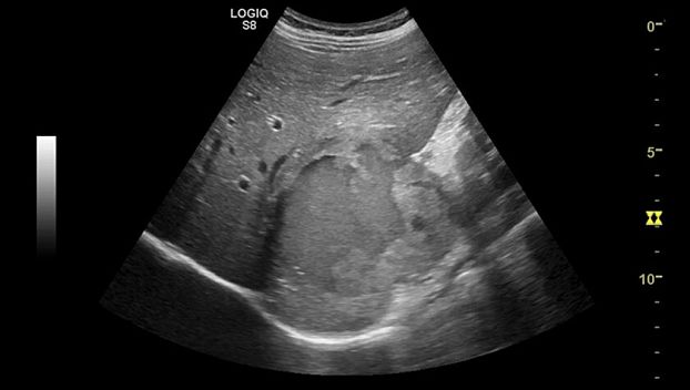 GE Logiq S8 XDclear ультразвуковая диагностическая система