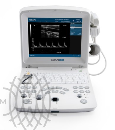 УЗИ аппарат Edan DUS 60