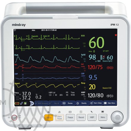 Mindray iPM12 bemor monitori