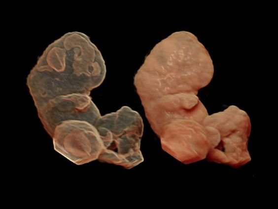 GE Voluson E10 аппарат УЗИ