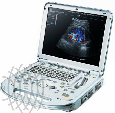 Mindray M7 Ultratovush skaneri portativ