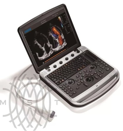 Ultratovush apparati Chison SonoBook 9
