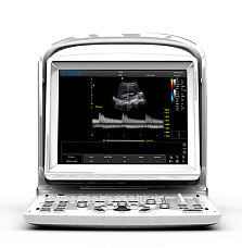 УЗИ аппарат Chison ECO 3 Expert