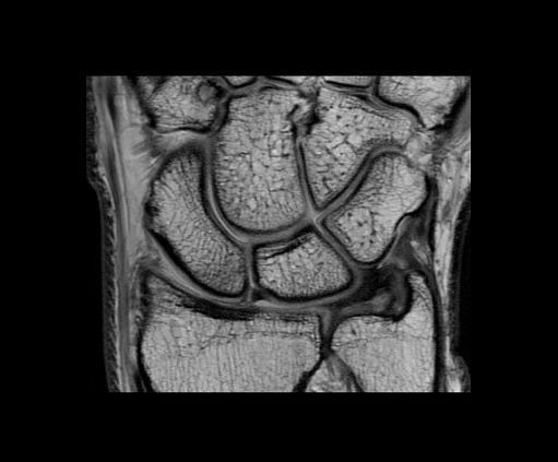 Магнитно-резонансный томограф GE SIGNA Architect 3T
