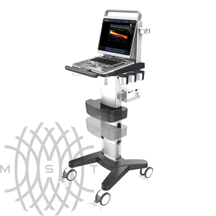 Chison EBit 30 ультразвуковой аппарат