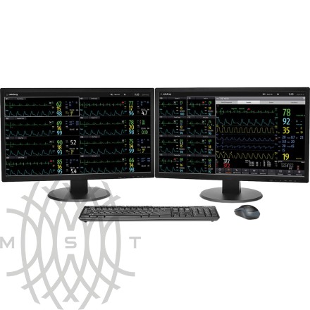 Markaziy monitoring stantsiyasi Mindray BeneVision CMS