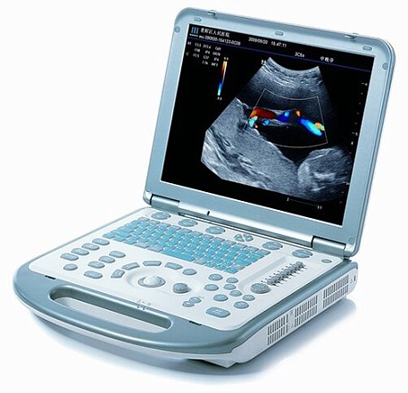 Ultratovush apparati Mindray M5 portativ