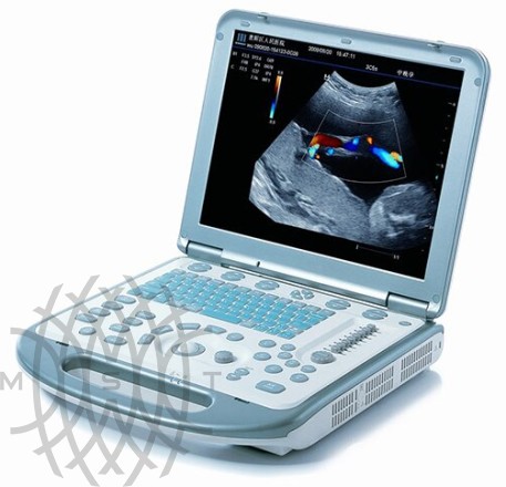 Ultratovush apparati Mindray M5 portativ